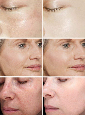 Set Blanqueador y Antienvejecimiento GlowSet™